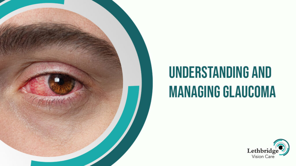 Understanding and Managing Glaucoma